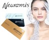 1ml Neuramis Lip Augmentation Hyaluronic Acid Dermal Filler