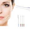 Hot Selling 23G 60mm Multi Pdo Thread for Face Lifting