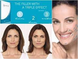 Hot Selling Radiesse Hyaluronic Acid Injection Skin Booster Reduce Nasolabial Folds Radiesse Plus Anti Aging Facial Wri