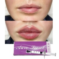 Long lasting time 9-12 month lip enhancement filler hyaluronic acid fillers gel