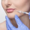 1ml hyaluronic acid dermal filler for hyaluronic pen use