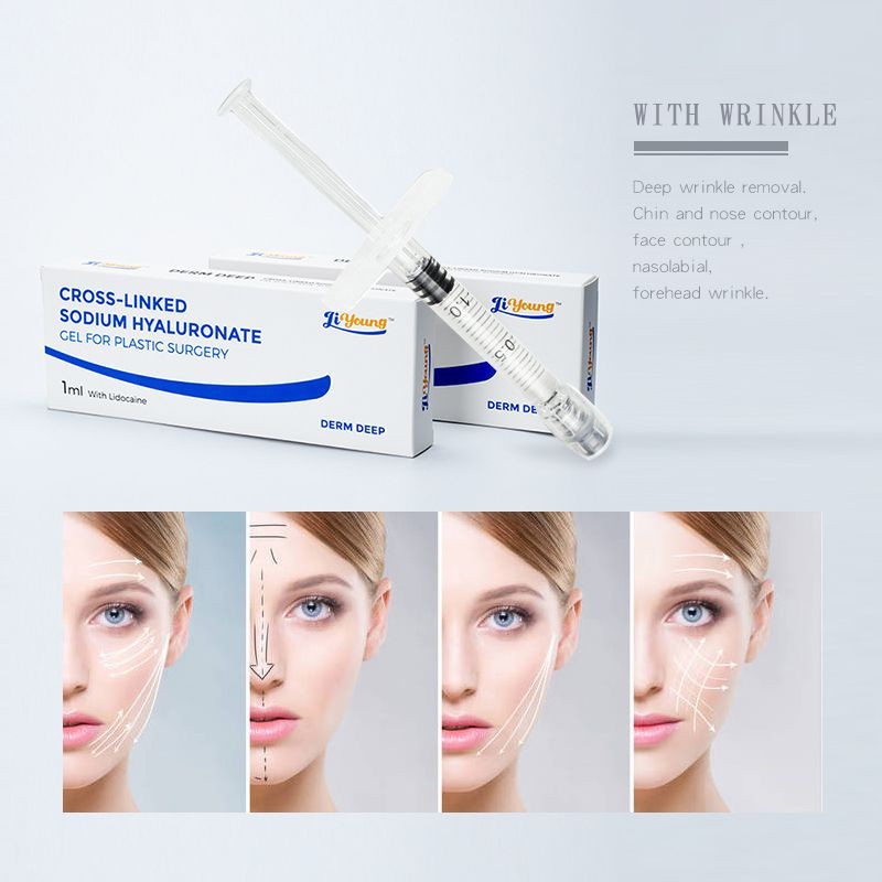 HA Cross-linked Hyaluronic Acid Injectable Filler /Dermal Filler