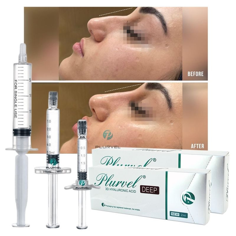 Plurvel Factory Price Manufacturer Ce Fine Cross Linked Hyaluronic Acid Dermal Filler Facial Filler For Wrinkles Thin L